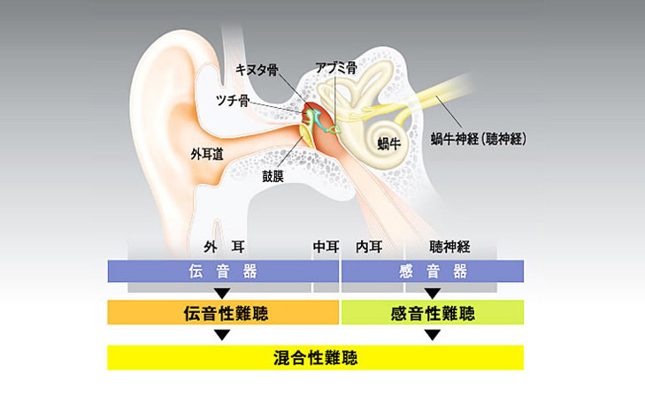 聞こえについて